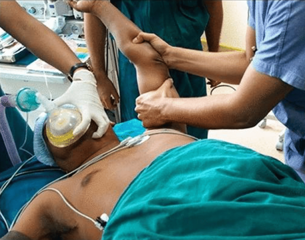 Manipulation Under Anaesthetic Procedure for a patient with frozen shoulder. Image shows doctors moving the frozen shoulder through its range of motion in flexion.