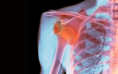 Dislocated Shoulder - Causes, Treatment and types of shoulder dislocations