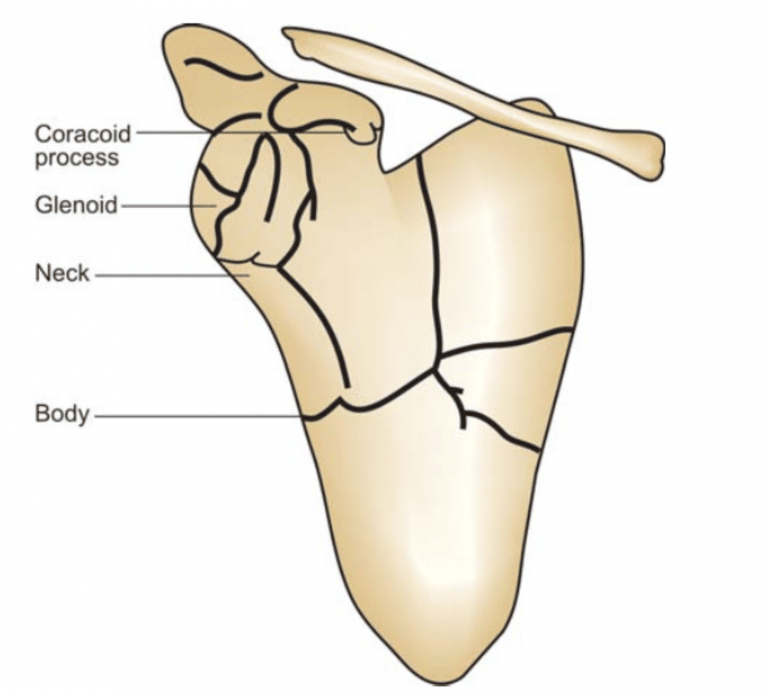 can-you-fracture-your-shoulder-blade-reflex-health