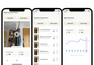 Image shows iOS app for measuring shoulder range of motion after broken shoulder