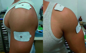 How to Use a TENS / EMS Unit for Shoulder Pain Relief - Ask Doctor